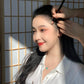 Receding Hairline Treatment